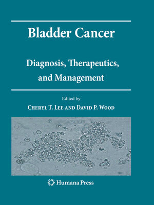 cover image of Bladder Cancer